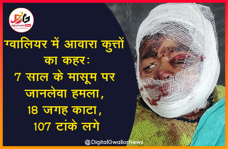 ग्वालियर में आवारा कुत्तों का कहर: 7 साल के मासूम पर जानलेवा हमला, 18 जगह काटा, 107 टांके लगे